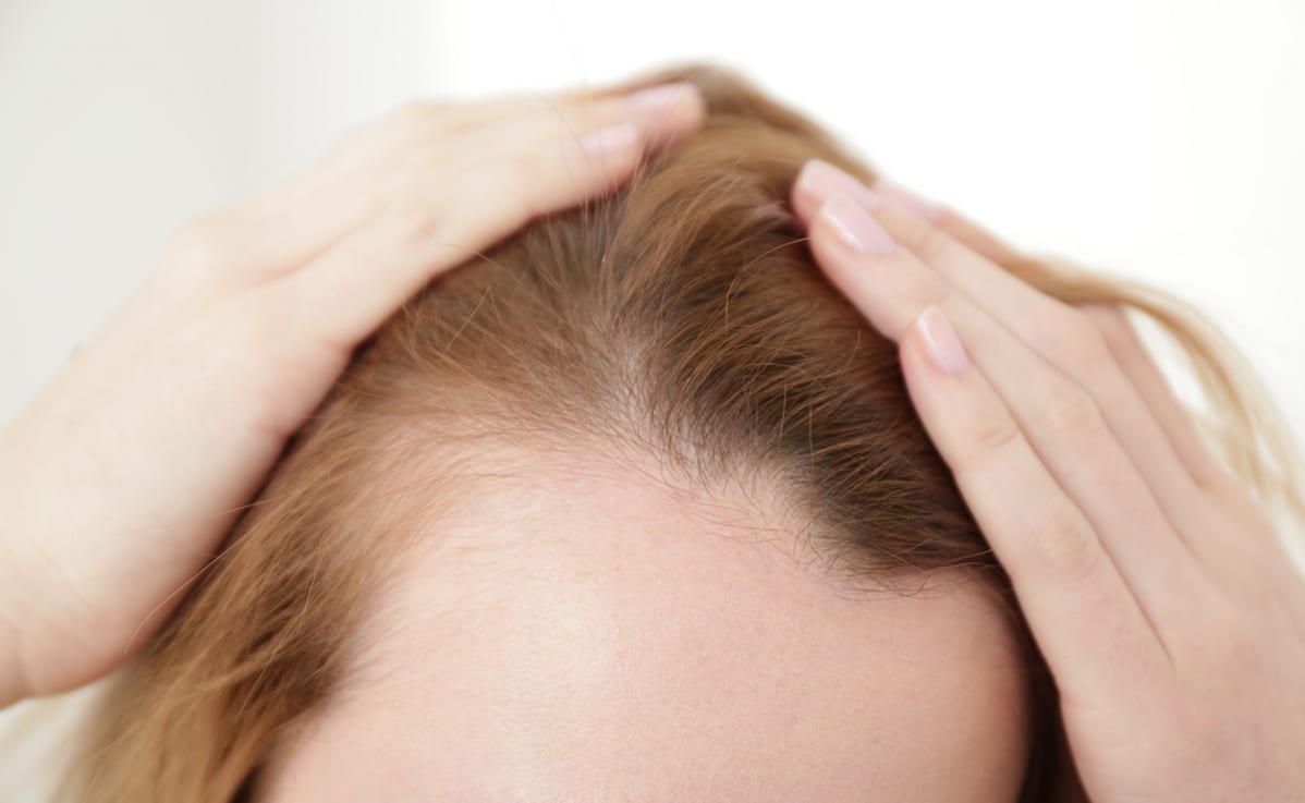 Hair Transplant Image 11