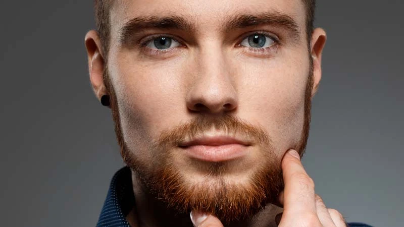 Hair Transplant Image 21
